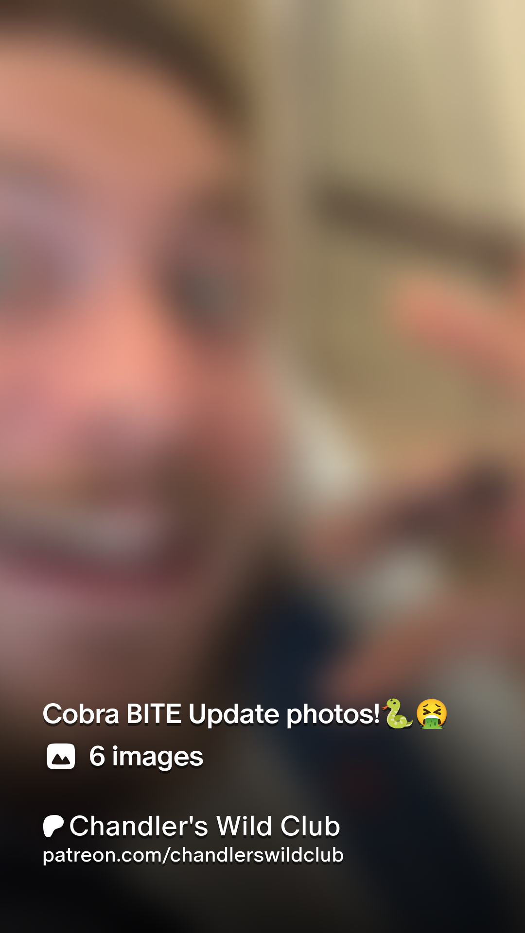 Cobra BITE Update photos!🐍🤮 | Patreon